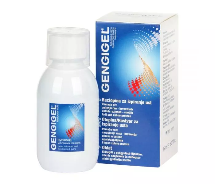 Gengigel szájöblögető oldat (150.0 ml)